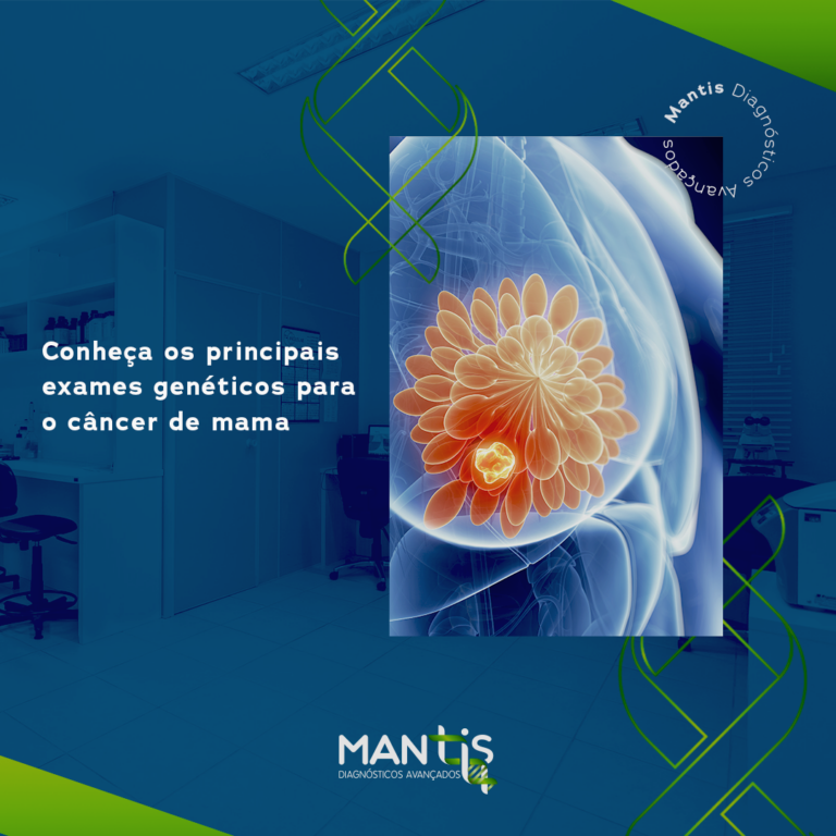 Conheça os principais exames genéticos para o câncer de mama Conheça os principais exames genéticos para o câncer de mama